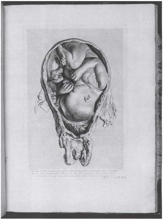An in utero drawing from the 18th century (item 171)